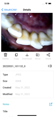 mouthcam instructions