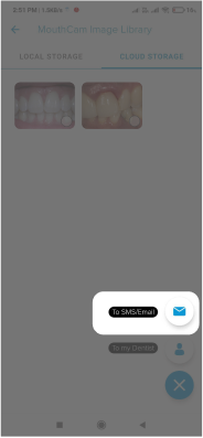 mouthcam instructions