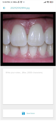 mouthcam instructions
