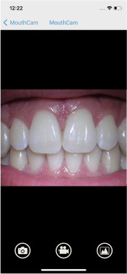 mouthcam instructions