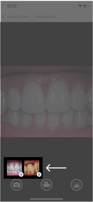 mouthcam instructions