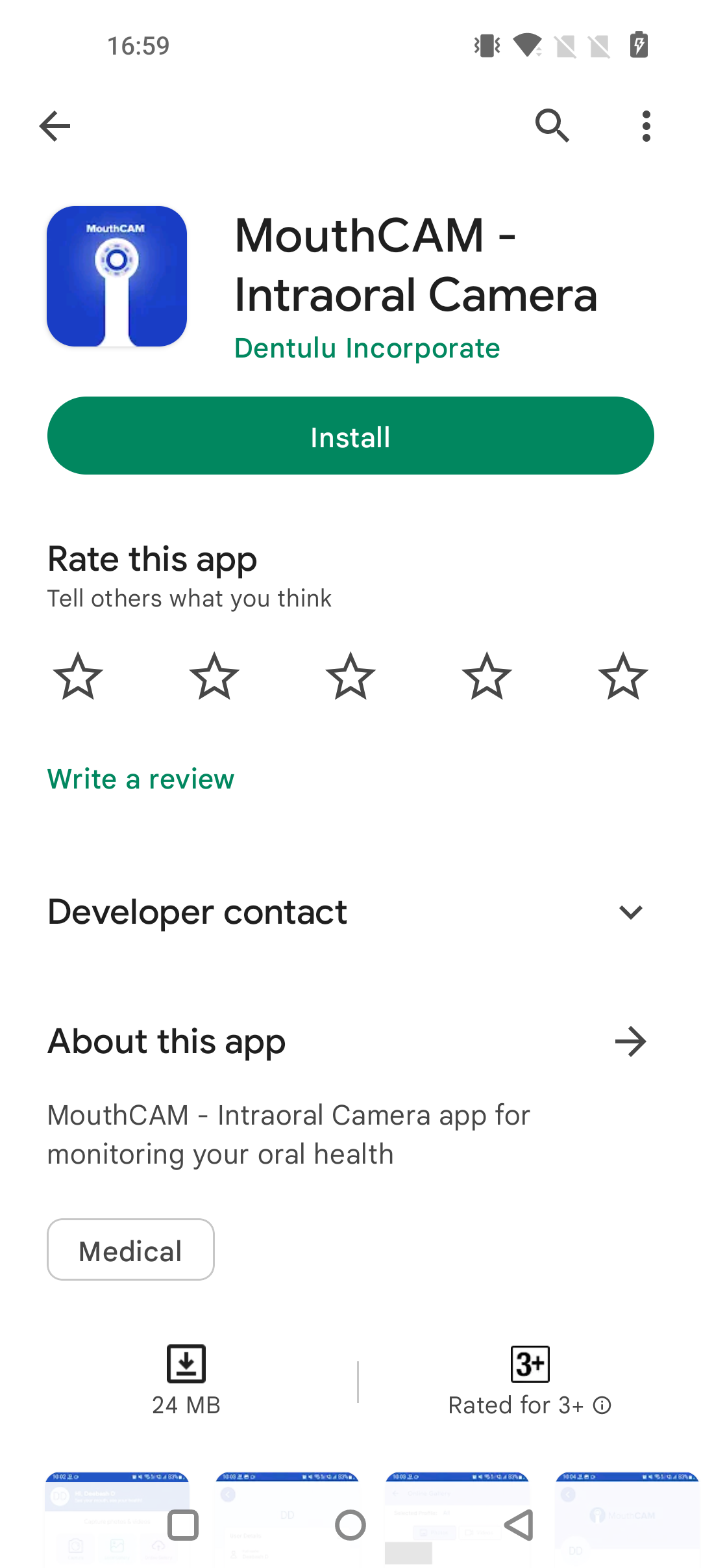 mouthcam instructions