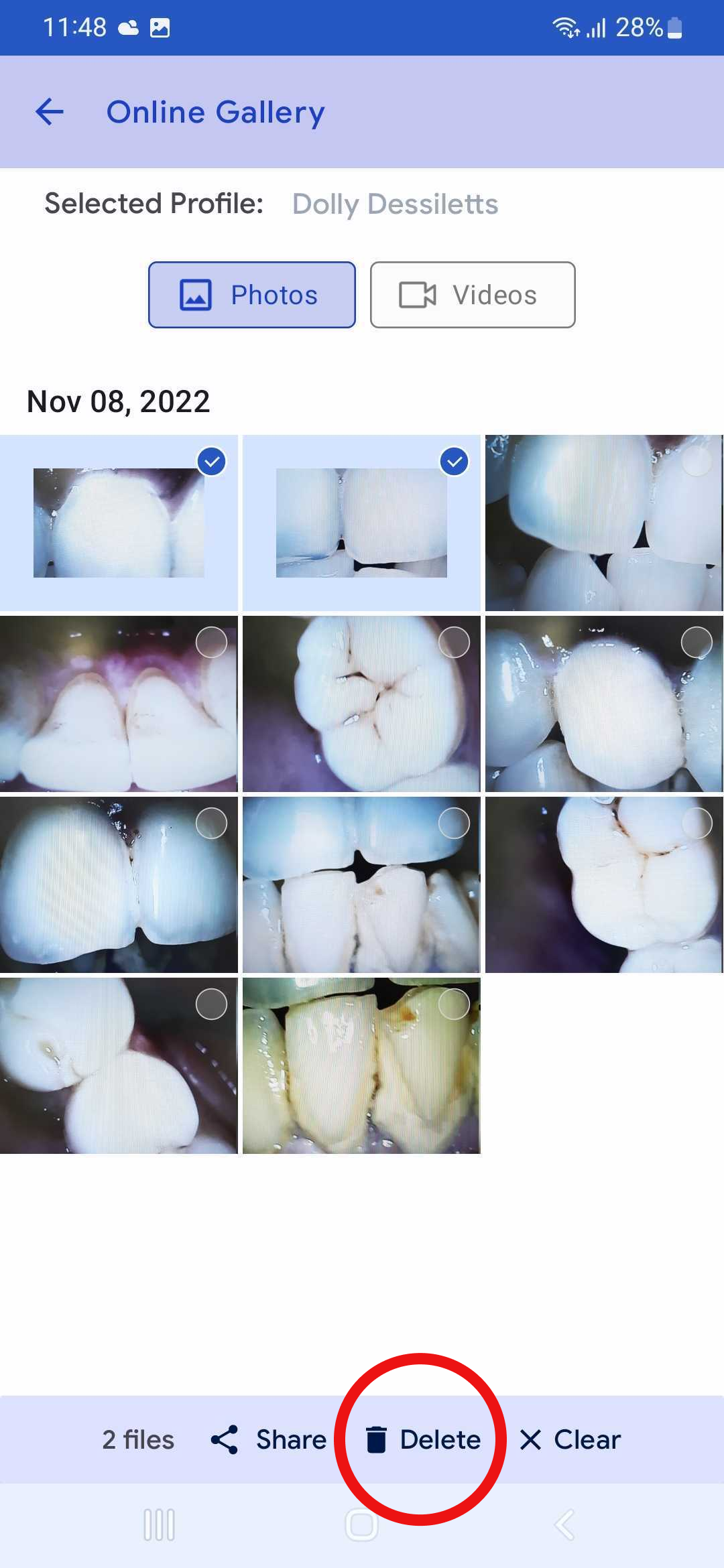 mouthcam instructions