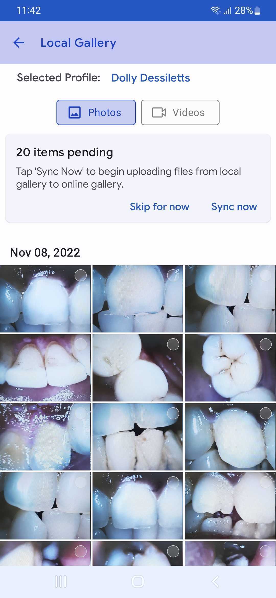 mouthcam instructions