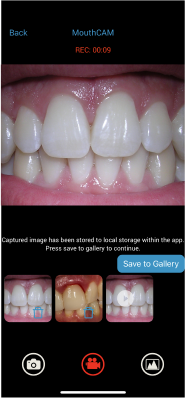 mouthcam instructions